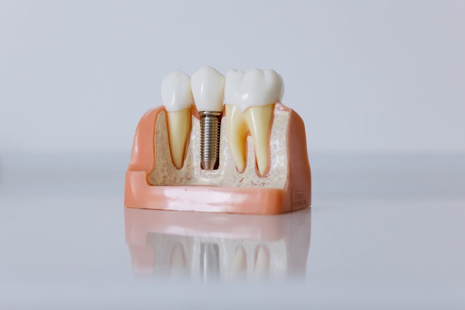 Diş İmplantı Nedir? Başlangıç Rehberi ve Temel Kavramlar