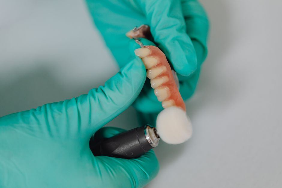 Implant Tedavisi Hakkında Sık Sorulan Sorular